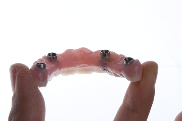 Will I Need A Bone Graft For The All On   Procedure?