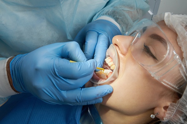 Tips On How To Care For Your Smile After A Dental Cleaning