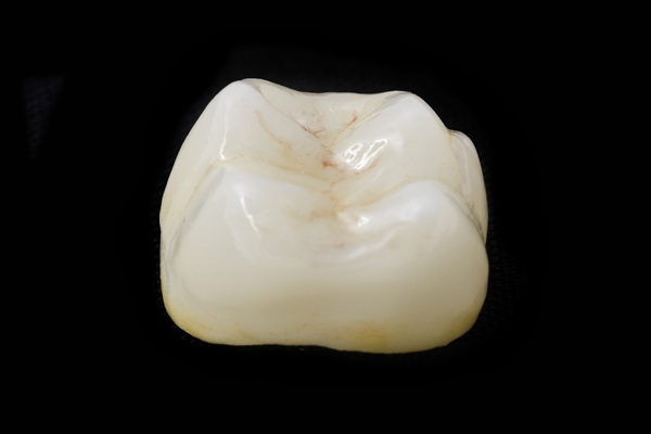 Dental Crown Placement: Front Vs  Back Teeth